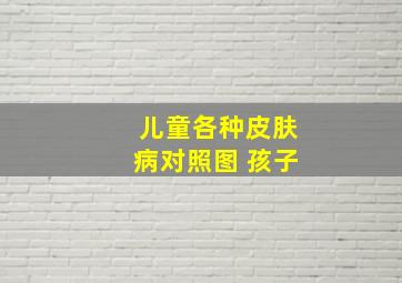 儿童各种皮肤病对照图 孩子